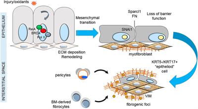 Nanoapproaches to Modifying Epigenetics of Epithelial Mesenchymal Transition for Treatment of Pulmonary Fibrosis